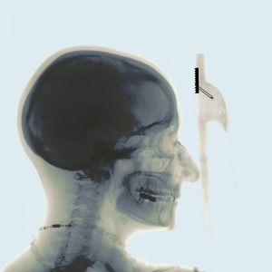 X-ray-skull-profile1