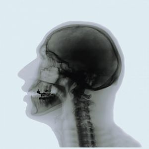 X-ray-skull-profile2