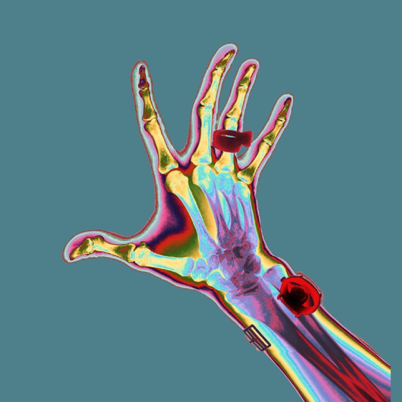 X-ray-hand2