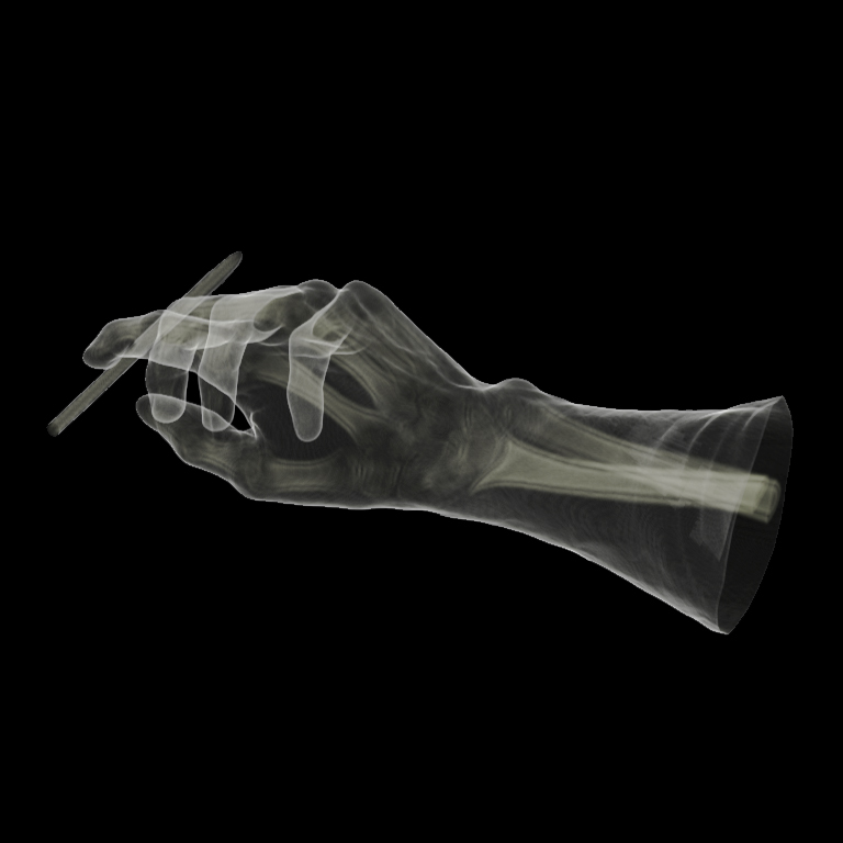 X-ray-hand3