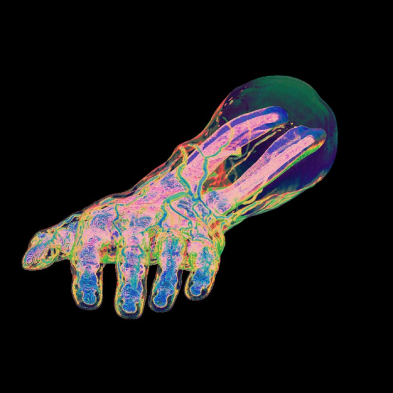 X-ray-hand