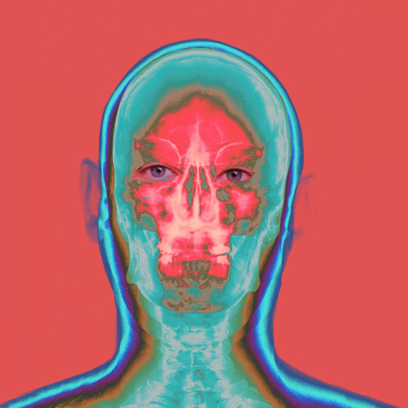 X-ray-head1